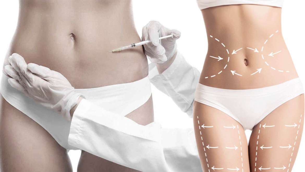 lipolysis